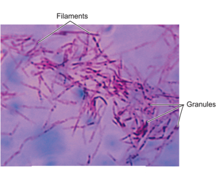 Figure 6. Filamentous Cell-Wall-Deficient Forms of Mycobacterium tuberculosis. 